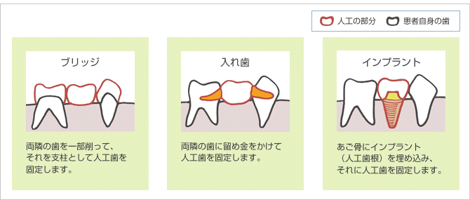 3つの治療法の比較