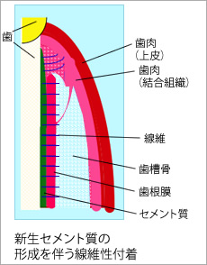 図2●バイオ・リジェネレーション法施術後の治癒形態