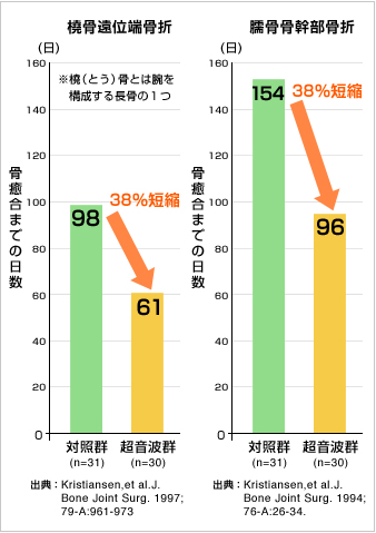 骨折の治療期間を3 4割早める 超音波骨折治療法 医学 医療最前線 先進医療 Net