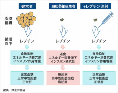 図1●フラップ手術後の治癒形態