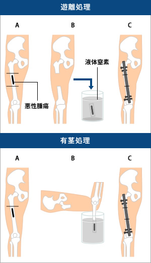 図●凍結処理の方法（例：大腿骨）
