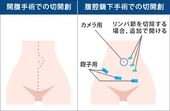 図●侵襲性の比較法