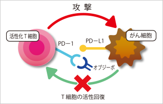 がん治療薬 オプジーボ の治療効果を早期に予測できる最新の検査法