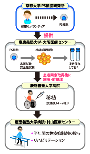 今回の臨床研究の概要