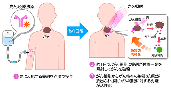 光免疫療法の仕組み