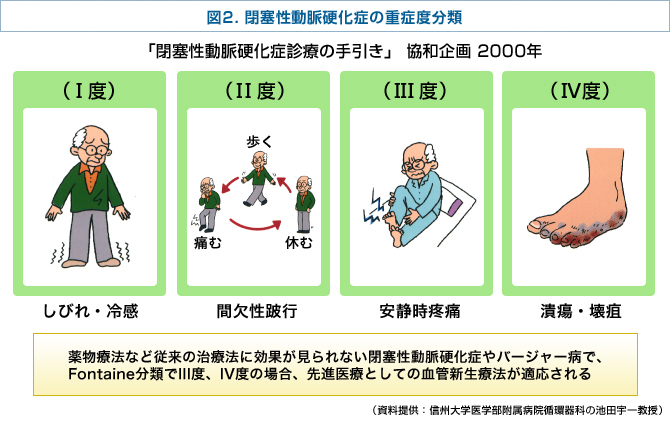 閉塞性動脈硬化症の重症度分類