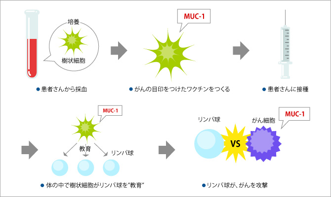 樹状細胞ワクチン治療のしくみ