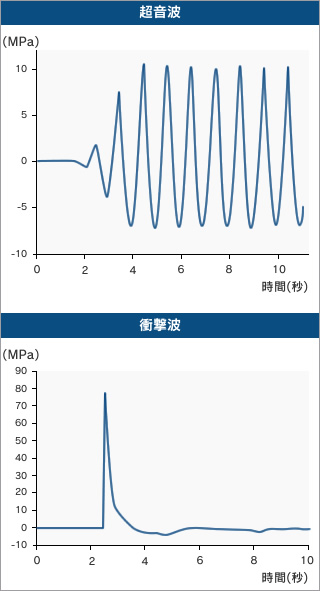 図1●超音波と衝撃波の比較