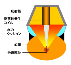 図2●衝撃波の発生原理