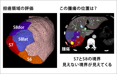 図2●系統的切除の“見える化”