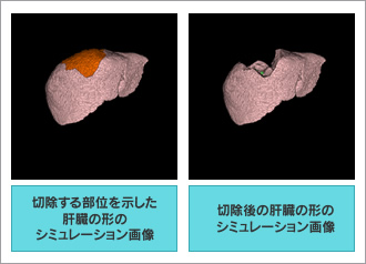 図2●系統的切除の“見える化”