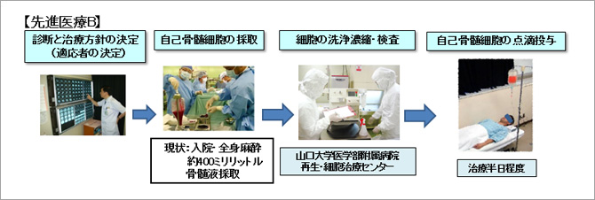 図1 自己骨髄細胞投与による肝臓再生療法