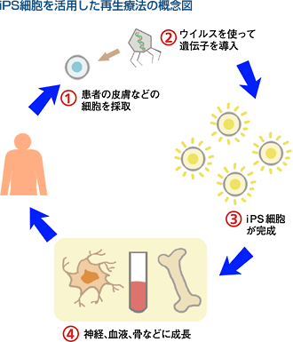 iPS細胞を活用した再生療法の概念図