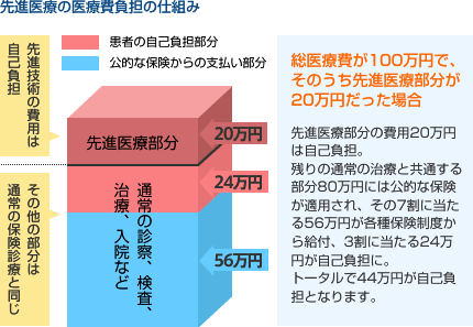 先進医療の医療費負担の仕組み